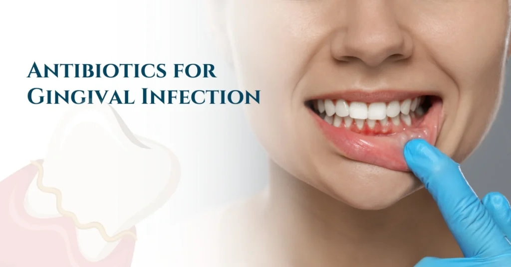 Antibiotics for Gingival Infection
