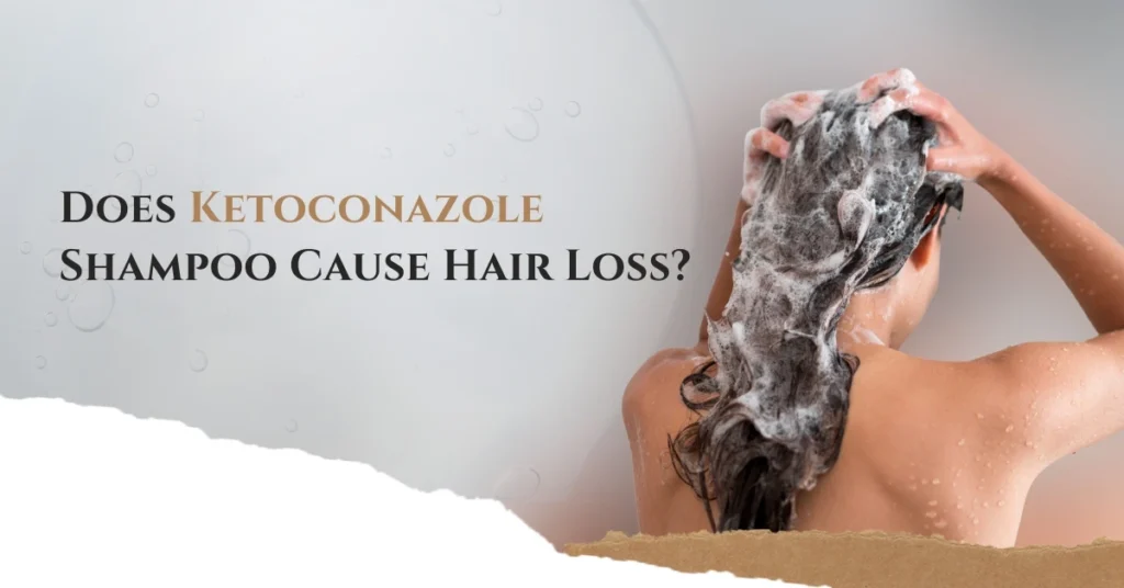 Does Ketoconazole Shampoo Cause Hair Loss